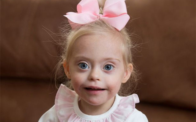 A Winning Smile: A Cute Toddler With Down’s Syndrome Gets A Modeling Contract