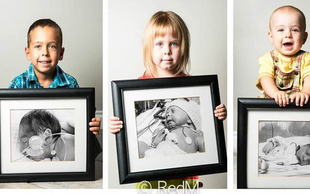Before And After:  Inspiring Portraits Of Premature Babies